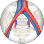 Main artery venous obstruction icon